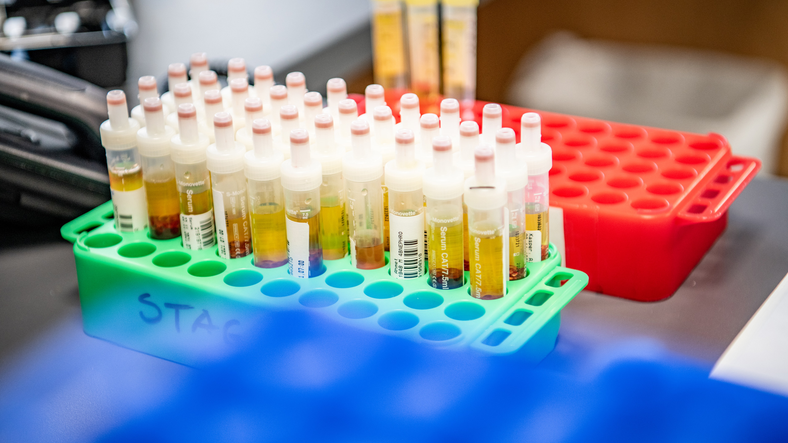 Medizinische Proben in kleinen Glas-Gefäßen